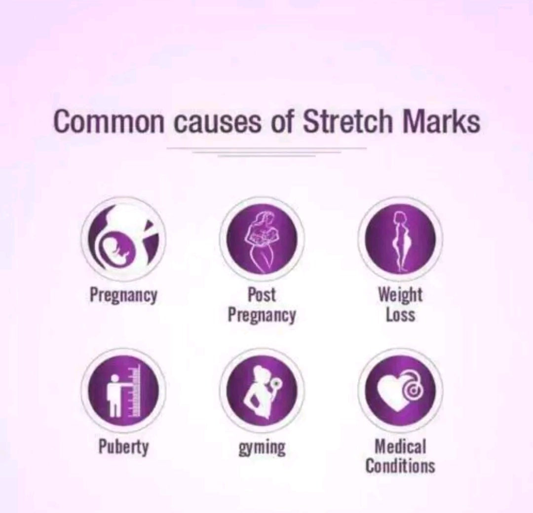 Mederma Stretchmarks Therapy Cream for Skin Repair Fades Stretch Marks Paraben Free Intensive Cream 5.29 oz