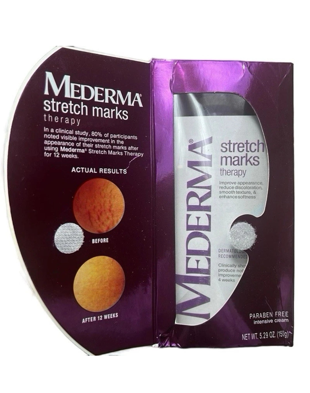 Mederma Stretchmarks Therapy Cream for Skin Repair Fades Stretch Marks Paraben Free Intensive Cream 5.29 oz