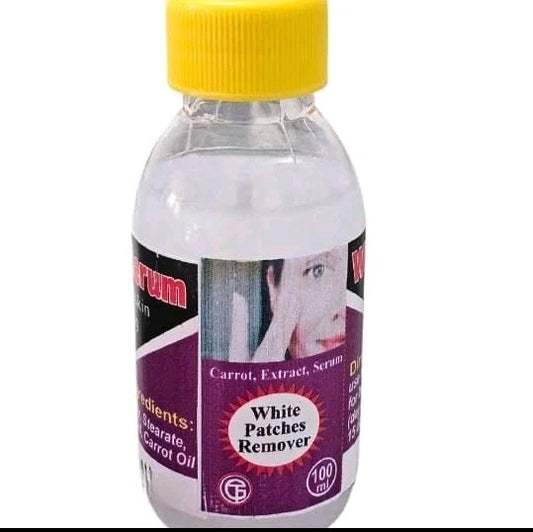 White Patches Remover Serum Prevent & Eliminate Patches, Discoloration, Green Vein